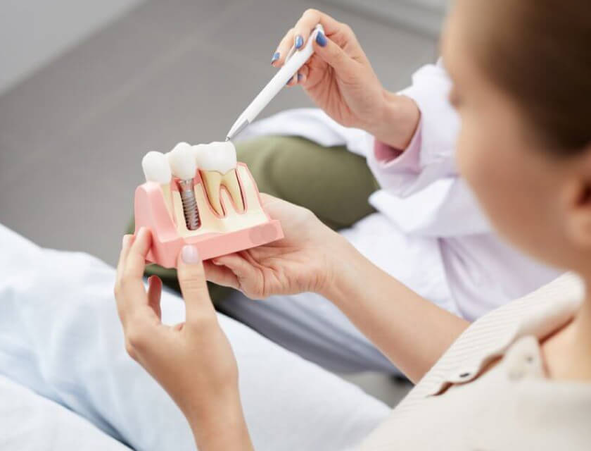 Your Guide to Dental Implants at a Top Dental Implant Clinic in Turkey